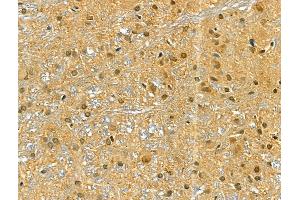 ABIN6266097 and ABIN6268826 at 1/100 staining Rat brain tissue by IHC-P.