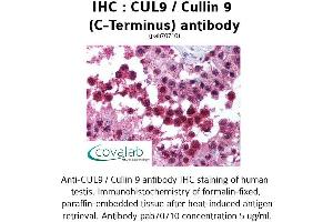 Image no. 1 for anti-Cullin 9 (CUL9) antibody (ABIN1733383) (CUL9 Antikörper)