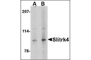 Western blot analysis of Slitrk4 in mouse brain tissue lysate with this product at (A) 0. (SLITRK4 Antikörper  (C-Term))