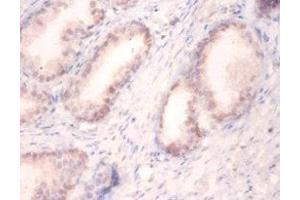 Immunohistochemistry of paraffin-embedded human prostate tissue using ABIN7174131 at dilution of 1:100 (SNRPA1 Antikörper  (AA 8-278))