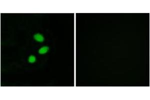 Immunofluorescence analysis of MCF7 cells, using TSH2 Antibody. (THNSL2 Antikörper  (AA 811-860))