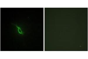 Immunofluorescence analysis of NIH-3T3 cells, using Adrenergic Receptor alpha-2A Antibody. (ADRA2A Antikörper  (AA 331-380))