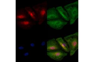 ABIN6259541 and ABIN6273711 staining  cells by IF/ICC. (REV1 Antikörper  (C-Term))