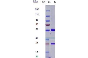 Anti-CD47 Reference Antibody (lemzoparlimab) on SDS-PAGE under reducing (R) condition. (Rekombinanter CD47 (Lemzoparlimab Biosimilar) Antikörper)