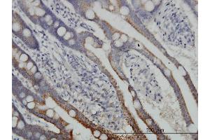 Immunoperoxidase of monoclonal antibody to DLD on formalin-fixed paraffin-embedded human small Intestine. (DLD Antikörper  (AA 1-509))