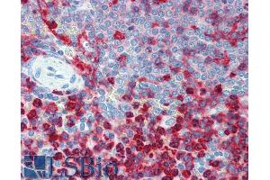 Immunohistochemistry staining of human spleen (paraffin sections) using anti-CD18 (Commercially tested by LifeSpan BioSciences. (Integrin beta 2 Antikörper)