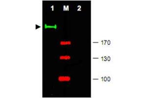 Western blot using Gli2 polyclonal antibody  shows detection of a predominant band at ~190 KDa corresponding to Gli2 (arrowhead) in mouse brain tissue lysate (Lane 1).