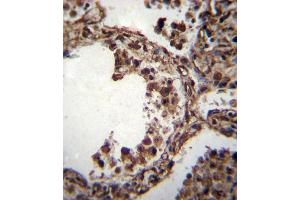 TUBA1C Antibody (C-term) (ABIN655982 and ABIN2845366) immunohistochemistry analysis in formalin fixed and paraffin embedded human lung tissue followed by peroxidase conjugation of the secondary antibody and DAB staining. (TUBA1C Antikörper  (C-Term))