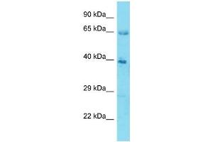 Host:  Rabbit  Target Name:  KLHL12  Sample Type:  Stomach Tumor lysates  Antibody Dilution:  1. (KLHL12 Antikörper  (N-Term))