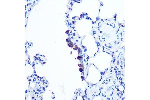 Immunohistochemistry of paraffin-embedded Rat lung using TOP1MT Rabbit pAb (ABIN7270851) at dilution of 1:100 (40x lens).