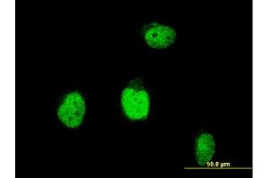 Immunofluorescence of monoclonal antibody to BLM on HeLa cell.