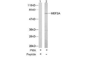 Image no. 1 for anti-Myocyte Enhancer Factor 2A (MEF2A) (Thr312) antibody (ABIN197165) (MEF2A Antikörper  (Thr312))