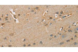 Immunohistochemistry of paraffin-embedded Human brain tissue using ARSA Polyclonal Antibody at dilution 1:50 (Arylsulfatase A Antikörper)