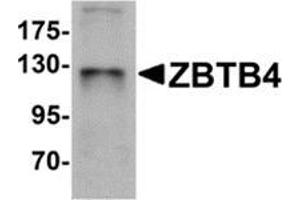 Western blot analysis of ZBTB4 in SK-N-SH cell lysate with ZBTB4 antibody at 1 μg/ml. (ZBTB4 Antikörper  (C-Term))