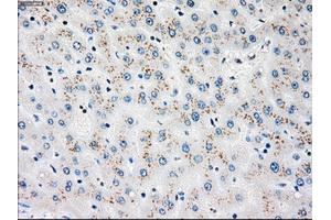 Immunohistochemical staining of paraffin-embedded liver tissue using anti-PLK1mouse monoclonal antibody. (PLK1 Antikörper)