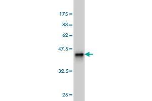 Western Blot detection against Immunogen (36. (DAZ1 Antikörper  (AA 21-120))
