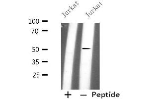 Western blot analysis of extracts from Jurkat cells, using PLD4 antibody.