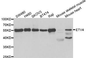 Western blot analysis of extracts of various cell lines, using ETV4 antibody (ABIN5973414) at 1/1000 dilution. (ETV4 Antikörper)
