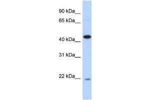 WB Suggested Anti-NOB1 Antibody Titration: 0. (NOB1 Antikörper  (N-Term))