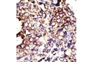 Immunohistochemistry (Paraffin-embedded Sections) (IHC (p)) image for anti-Glucosaminyl (N-Acetyl) Transferase 1, Core 2 (GCNT1) (AA 88-117) antibody (ABIN389033)