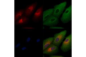 ABIN6257141 and ABIN6274489 staining  cells by IF/ICC.