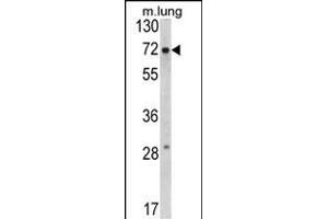 Western blot analysis of FMR1 Antibody (N-term) (ABIN390866 and ABIN2841083) in mouse lung tissue lysates (35 μg/lane). (FMR1 Antikörper  (N-Term))
