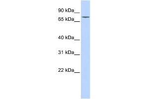 WB Suggested Anti-GALC Antibody Titration:  0. (GALC Antikörper  (Middle Region))