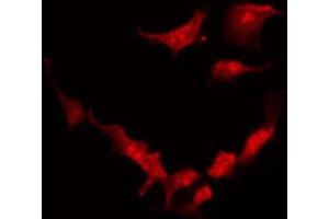 ABIN6273921 staining HeLa by IF/ICC. (FZD2 Antikörper  (Internal Region))
