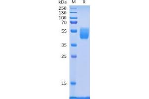 Human PSCA Protein, hFc Tag on SDS-PAGE under reducing condition. (PSCA Protein (Fc Tag))