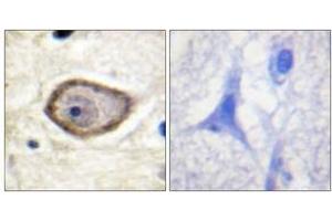 Immunohistochemistry analysis of paraffin-embedded human brain, using Coagulation Factor III (Phospho-Ser290) Antibody.