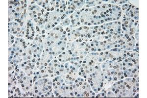 Immunohistochemical staining of paraffin-embedded colon tissue using anti-BRAFmouse monoclonal antibody. (BRAF Antikörper)