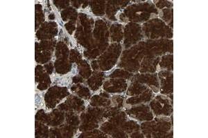 Immunohistochemical staining of human stomach with ABHD2 polyclonal antibody  shows strong cytoplasmic positivity in glandular cells at 1:10-1:20 dilution. (ABHD2 Antikörper)