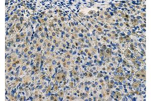 ABIN6264633 and ABIN6277558 at 1/100 staining Rat ovarian tissue by IHC-P. (RANGAP1 Antikörper  (N-Term))