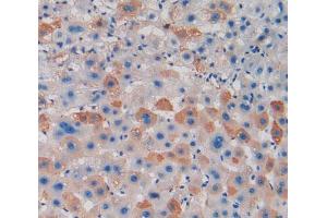 IHC-P analysis of liver tissue, with DAB staining. (PAD4 Antikörper  (AA 1-300))