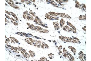 RNF40 antibody was used for immunohistochemistry at a concentration of 4-8 ug/ml to stain Skeletal muscle cells (arrows) in Human Muscle. (RNF40 Antikörper  (C-Term))