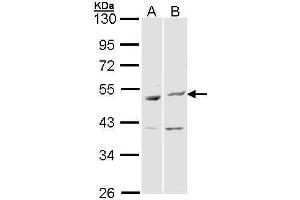 WB Image Sample (30 ug of whole cell lysate) A: Hela B: Molt-4 , 10% SDS PAGE antibody diluted at 1:1000 (BAG5 Antikörper)