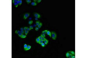 Immunofluorescence (IF) image for anti-Deiodinase, Iodothyronine, Type III (DIO3) (AA 50-115) antibody (ABIN7172188)