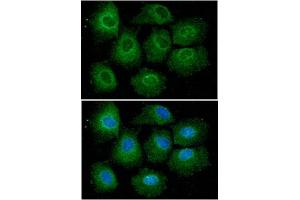 Immunofluorescent staining of Hep3B cell line with antibody. (VHL Antikörper  (AA 1-154))