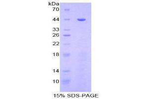 SDS-PAGE (SDS) image for Golgi Membrane Protein 1 (GOLM1) (AA 119-223) protein (His tag,GST tag) (ABIN2122927)