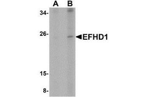 Western blot analysis of EFHD1 in human spleen tissue lysate with AP30309PU-N EFHD1 antibody at (A) 2 and (B) 4 μg/ml. (EFHD1 Antikörper  (N-Term))