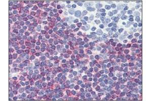 Immunohistochemistry (IHC) image for anti-Programmed Cell Death 4 (PDCD4) (AA 1-469), (N-Term) antibody (ABIN317548) (PDCD4 Antikörper  (N-Term))