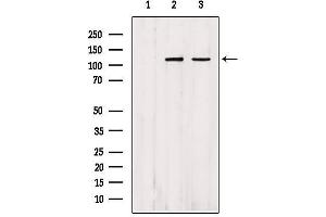 Western blot analysis of extracts from various samples, using IPO4 Antibody. (Importin 4 Antikörper  (Internal Region))