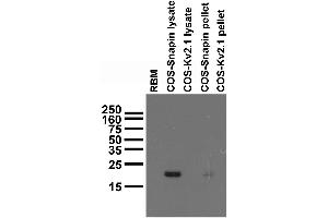 Immunoblot on adult rat brain membrane (RBM) and samples from transfected COS cells.