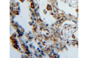 Immunohistochemistry (IHC) image for anti-Heparanase (HPSE) (AA 419-535) antibody (ABIN1859188)