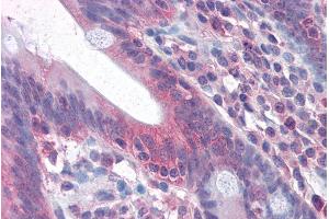 Immunohistochemistry (IHC) image for anti-TNF Receptor Superfamily, Member 6 (FAS) (Internal Region) antibody (ABIN571054)