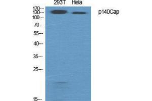 Western Blot (WB) analysis of specific cells using p140Cap Polyclonal Antibody. (SRCIN1 Antikörper  (Internal Region))