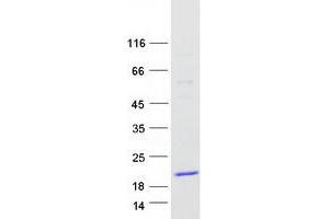 Validation with Western Blot (TCL1B Protein (Transcript Variant 1) (Myc-DYKDDDDK Tag))