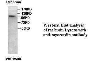 Image no. 1 for anti-Myocardin (MYOCD) antibody (ABIN791202) (Myocardin Antikörper)
