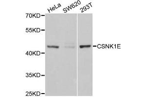 Western Blotting (WB) image for anti-Casein Kinase 1, epsilon (CSNK1E) antibody (ABIN1980191) (CK1 epsilon Antikörper)