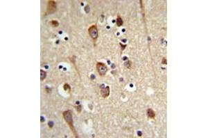 Immunohistochemistry analysis in formalin fixed and paraffin embedded brain tissue reacted with LUC7L2 Antibody (C-term) followed which was peroxidase conjugated to the secondary antibody and followed by DAB staining.